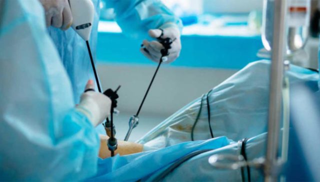 جراحات المناظير وعمليات السمنة