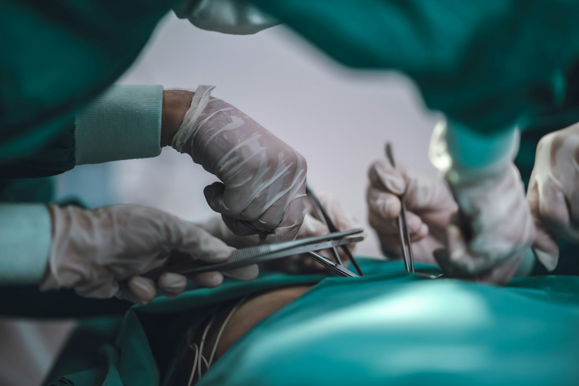 البواسير 2 Anesthetist surgery doctor professional team are working in hospital operating room