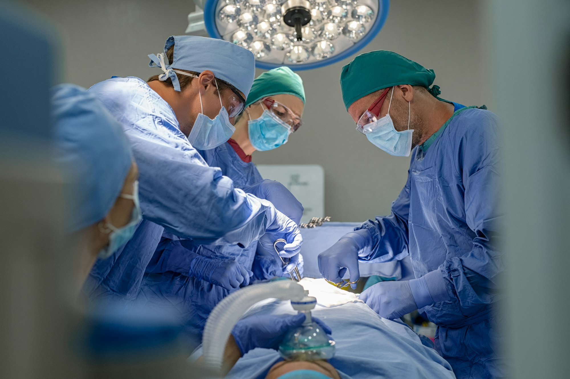 استئصال المرارة 2 Team of surgeons performing surgery
