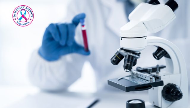 تشخيص الأورام