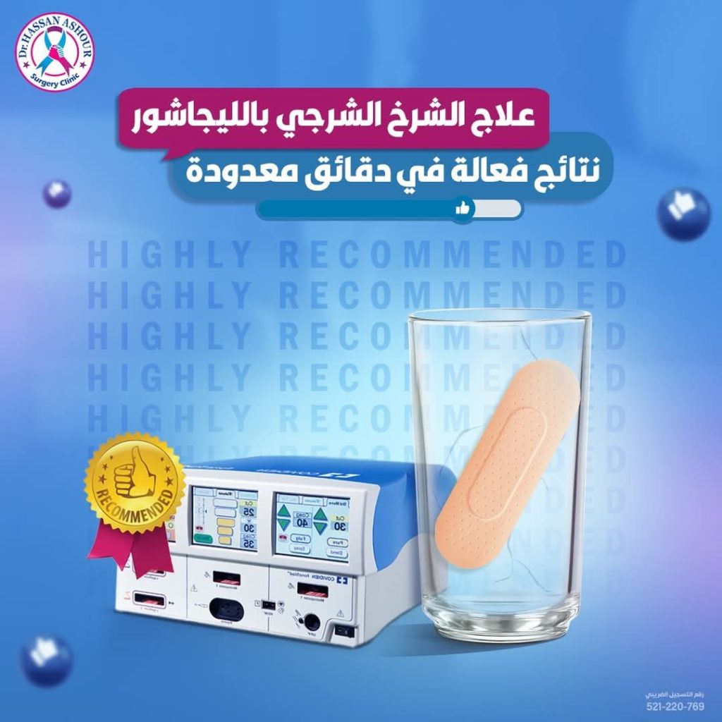 علاج الشرخ الشرجي بالليجاشور وبطرق أخرى عديدة 4 علاج الشرخ الشرجي في مركز دكتور حسن عاشور