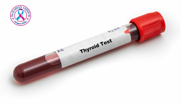 تحليل الغدة الدرقية