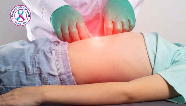 ما هو الفتق السري؟