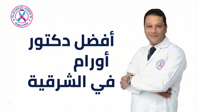 الدكتور حسن عاشور - افضل دكتور اورام في الشرقية 2026 2 الدكتور حسن عاشور - افضل دكتور اورام في الشرقية 2026