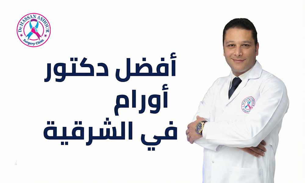 الدكتور حسن عاشور - افضل دكتور اورام في الشرقية 2026
